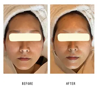 Yoshino Erinaのエステ・リラクイメージ