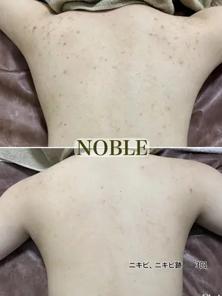 NOBLE 新宿本店のエステ・リラクイメージ