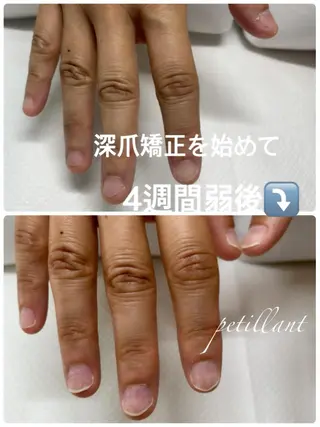 ネイル nail salon petillantのネイルデザイン