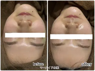 ENCHANT 脱毛.小顔.毛穴のエステ・リラクイメージ