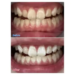 M渋谷 ホワイトニングのエステ・リラクイメージ