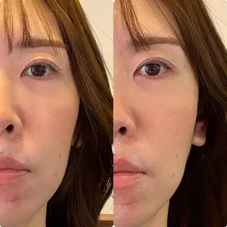 小顔矯正/姿勢矯正 美容整体師 野口杏太のエステ・リラクイメージ