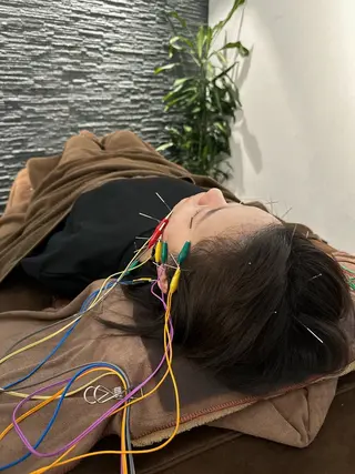 小顔矯/美容鍼/鍼灸 BeauJuのその他イメージ