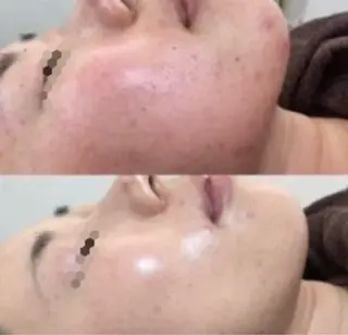 痩身専門サロン マハロミのエステ・リラクイメージ