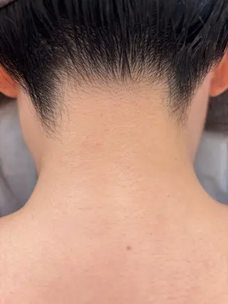 脱毛サロンwillow所属・脱毛サロン Willow /棚村のエステ・リラクイメージ