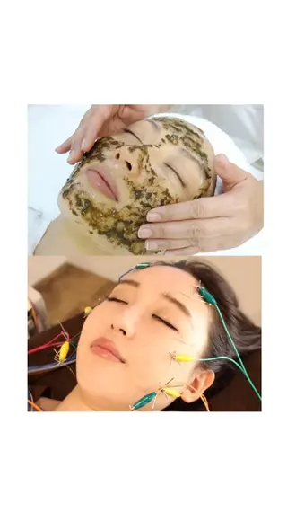 💙美容鍼💙美顔矯 正🧡Brilo🧡のエステ・リラクイメージ