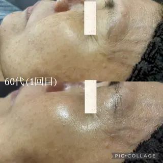 メンズ Beauty Salonheartのエステ・リラクイメージ