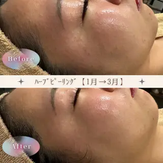 ゆか/エステサロン Lilasmileのエステ・リラクイメージ