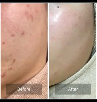 ハーブピーリング専門 MOKAのエステ・リラクイメージ