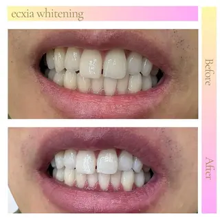 セルフホワイトニング エクシア武蔵小杉店のその他イメージ