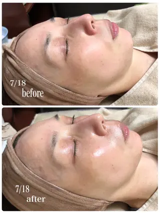 サロン・ド・ポラリス所属・サロンド ポラリスのエステ・リラクイメージ