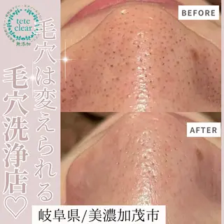 and R 男女 脱毛、毛穴サロンのエステ・リラクイメージ