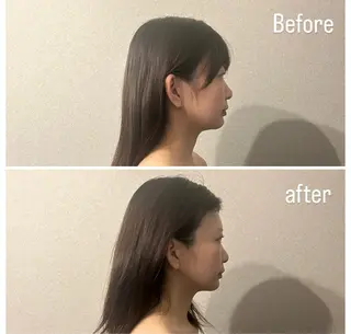 圧倒的たるみ改善 美容鍼エステのエステ・リラクイメージ