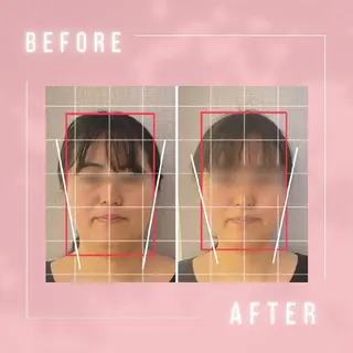 小顔・肌悩み専門店 ボーテドリッシュのエステ・リラクイメージ