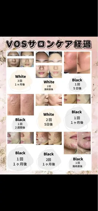 エステサロン Mi-mi.iのエステ・リラクイメージ