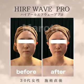 小顔サロン Marottのエステ・リラクイメージ
