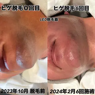 脱毛・眉毛・フェイス サロンN久留米店の眉毛・アイブロウイメージ