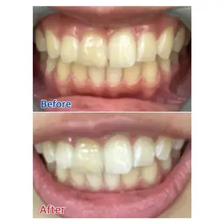 M渋谷 ホワイトニングのエステ・リラクイメージ