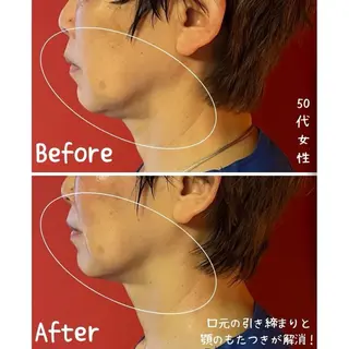 表情筋フェイシャル 三軒茶屋のエステ・リラクイメージ