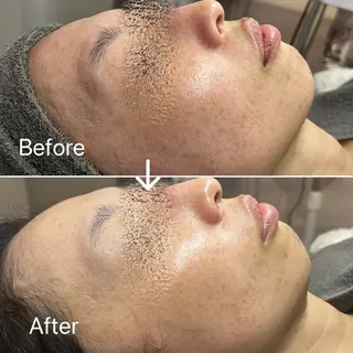 Blue Moon 【ブルームーン】のエステ・リラクイメージ