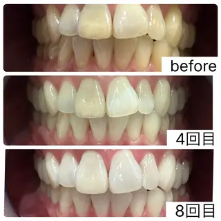 The Salon 脱毛&眉毛の眉毛・アイブロウイメージ