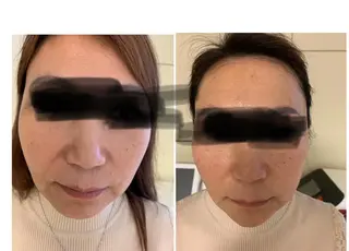 aliaハーブ水光店 エステティシャン募集のエステ・リラクイメージ