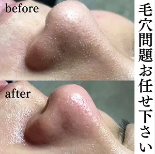 beautysalonW所属・beauty salonWのエステ・リラクイメージ