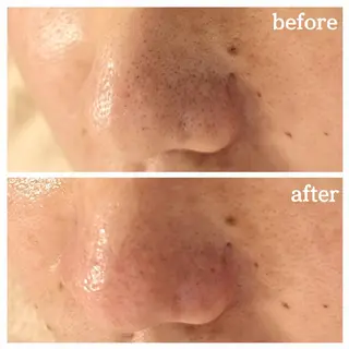 フェイシャル専門サロ ン　ERINのエステ・リラクイメージ