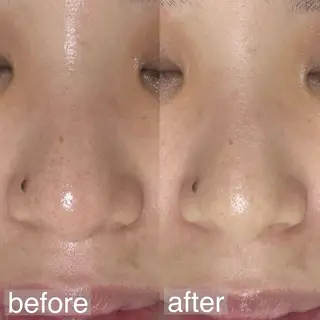 アイブロウ&フェイシャルサロンa‘lm所属・WAX脱毛/肌質改善 眉毛とお肌のサロンのエステ・リラクイメージ