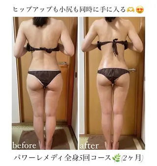 《本気痩せ×疲労改善 》  BILOOPのエステ・リラクイメージ
