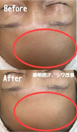 Surien 水脇ゆうのその他イメージ