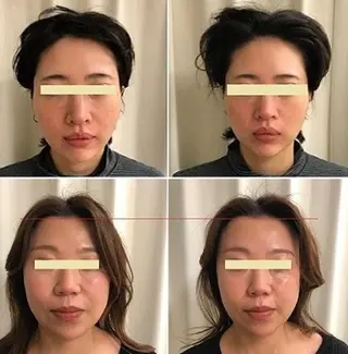 全身脱毛＆VIO脱毛 紹介率№1♪リナ♪のエステ・リラクイメージ