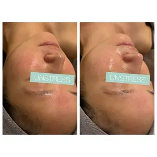 小顔コルギ ☆表参道/外苑前のエステ・リラクイメージ