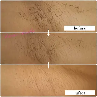 DIONE 麻布十番店のエステ・リラクイメージ