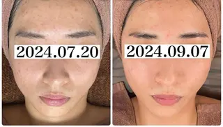 中目黒ハーブピーリン グ🌿ララピールのエステ・リラクイメージ