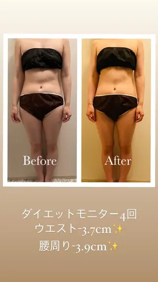 ワンネス トータルビューティーの眉毛・アイブロウイメージ