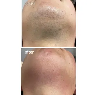 DISINISPA 脱毛/フェイシャルのエステ・リラクイメージ