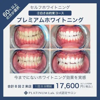 Whitening Beauty 行橋店のその他イメージ