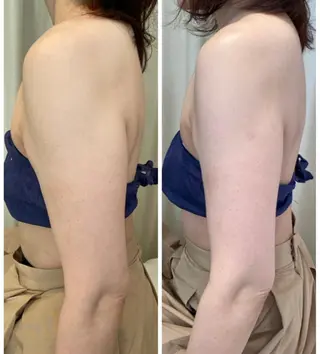 【ニキビ/肌管理】 salon varyのエステ・リラクイメージ