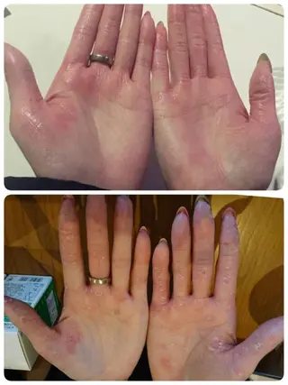 🏳️‍🌈 CHIYAKAのエステ・リラクイメージ