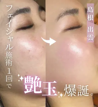 abbellina×uno所属・Anna / 出雲・肌質改善のエステ・リラクイメージ