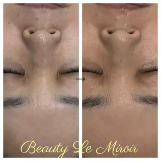 マツエク・マツパ ビューティー ミロワールのエステ・リラクイメージ