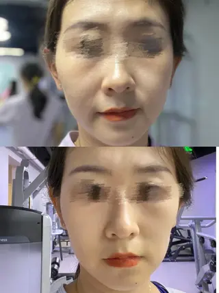 マツエク・マツパ aliaハイフ&水光ジェットサロン所属・aliaハーブ水光店 エステティシャン募集のエステ・リラクイメージ