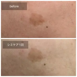 トータルしみケア専門 NICA(ニカ)の眉毛・アイブロウイメージ