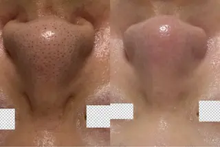 Nature Souce毛穴専門店のその他イメージ