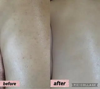 3/25迄ハーブ ピーリングBloomのエステ・リラクイメージ