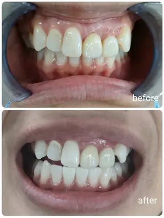 ecxia  white 　広島袋町店所属・セルフホワイトニング エクシア広島袋町店のその他イメージ