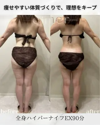 aimer 佐々木のエステ・リラクイメージ