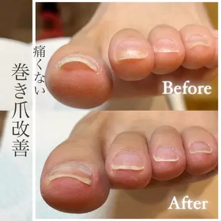 ネイル Fairy tail / miyukaのネイルデザイン