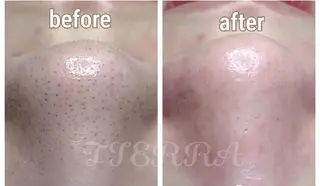 TIERRA(ティエラ)所属・TIERRA ♡のエステ・リラクイメージ